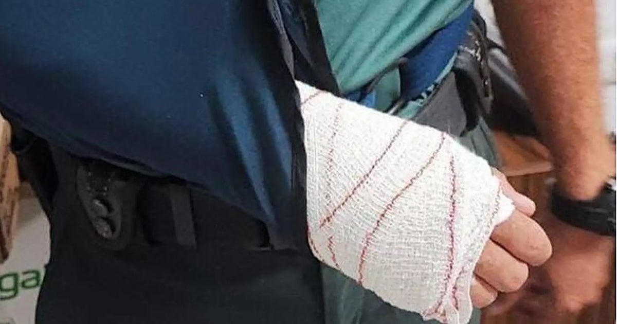 Brazo de un guardia civil con la mano vendada y en cabestrillo, símbolo de las lesiones sufridas por las agresiones a agentes.
